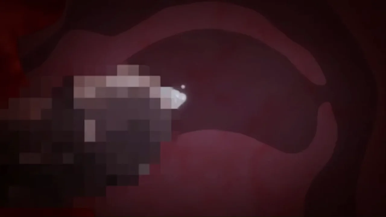 Thumbnail at 0:13