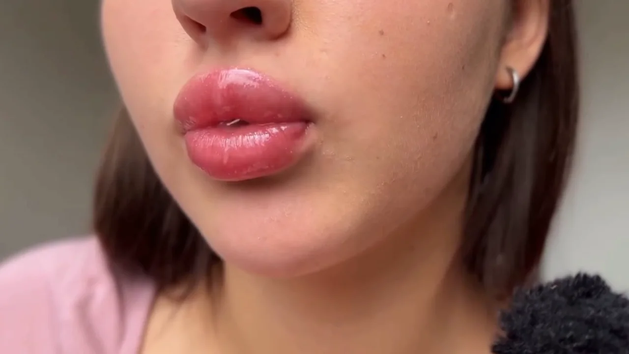 Thumbnail at 0:26