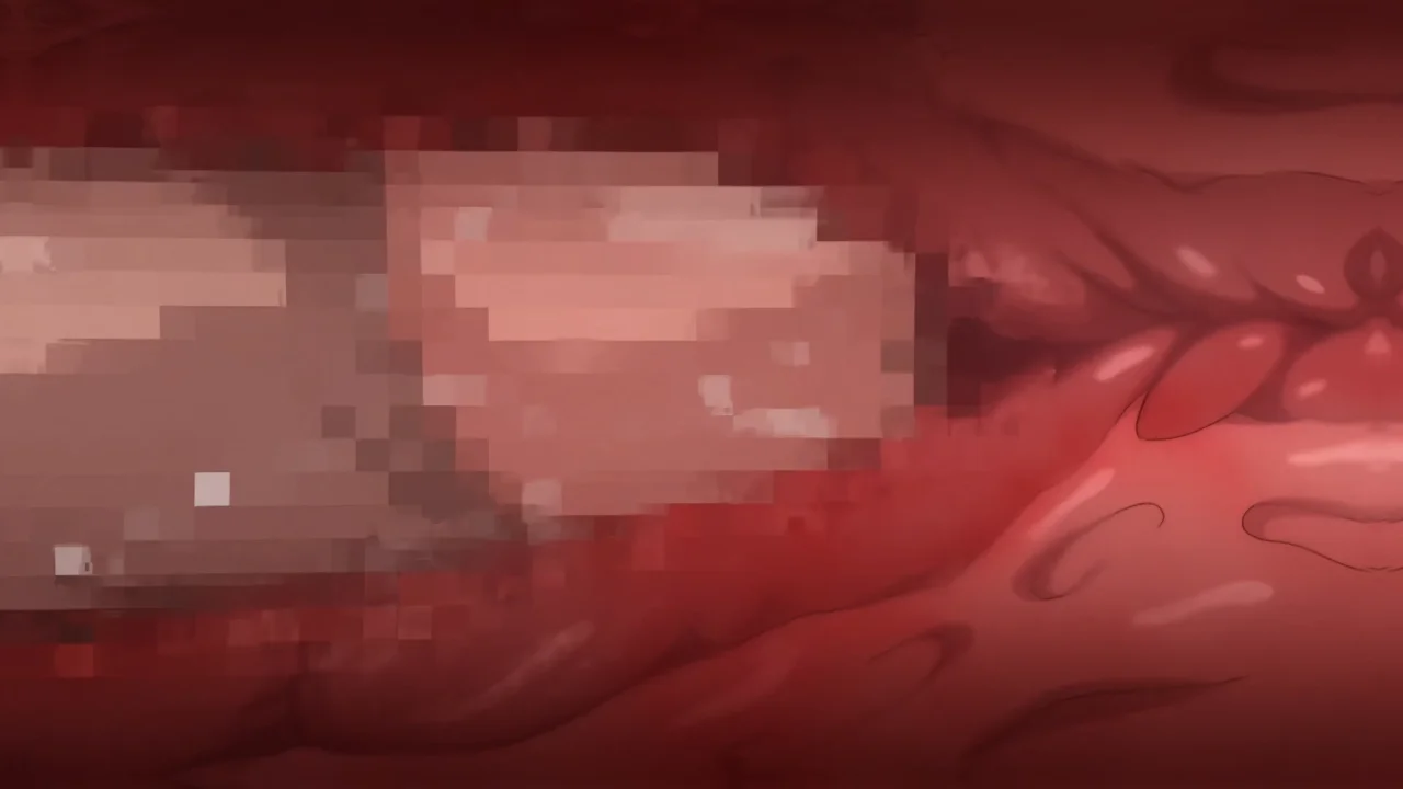Thumbnail at 0:41