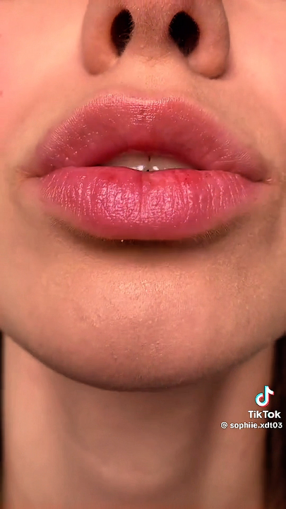 Thumbnail at 3:10